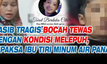Peristiwa Tragis Di Sukabumi, Anak Tewas Dengan Tubuh Melepuh