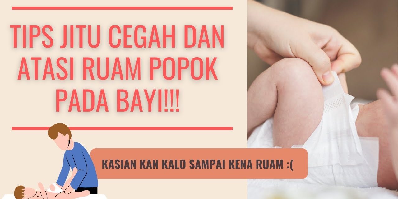 Waspada Ruam Popok Pada Bayi, Ini Cara Pelindung Kulitnya