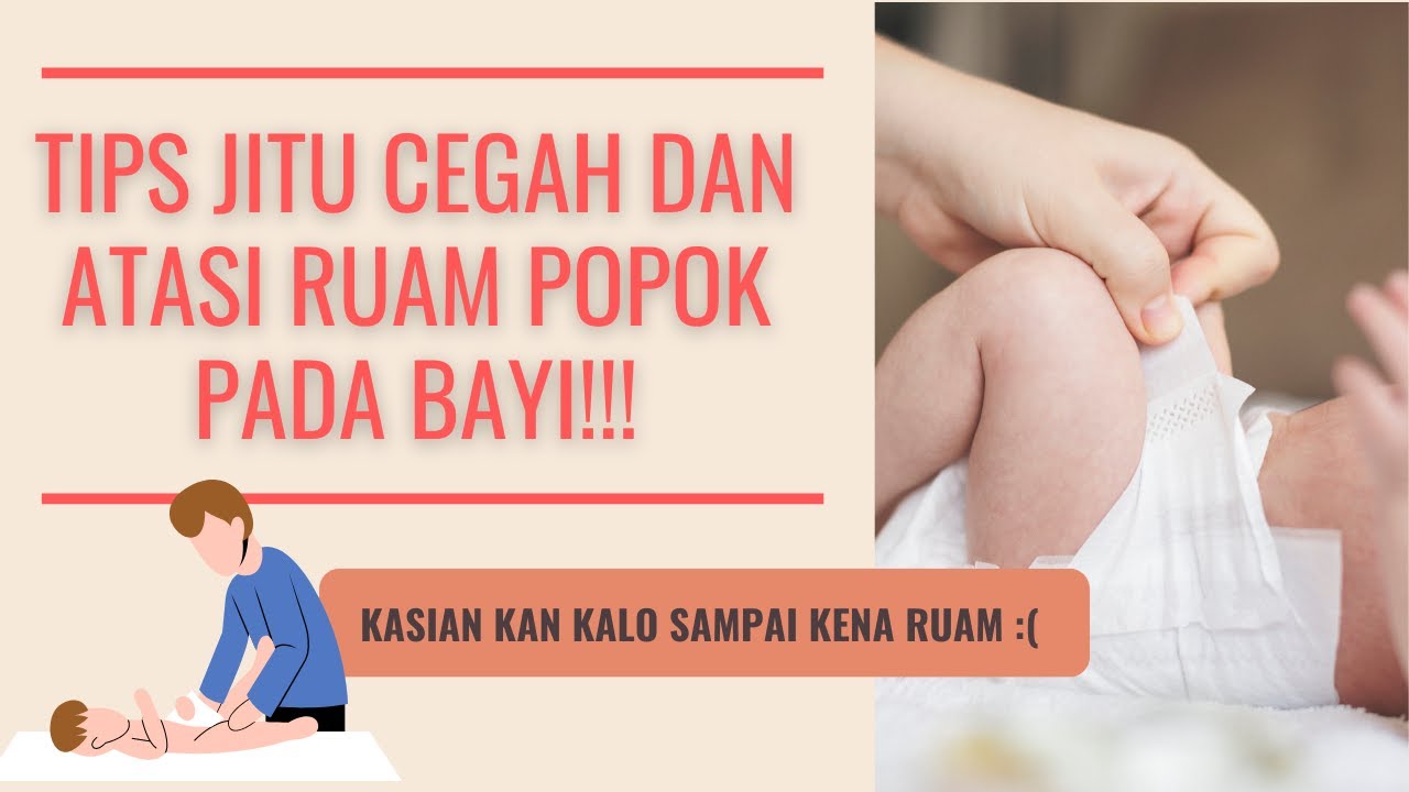 Waspada Ruam Popok