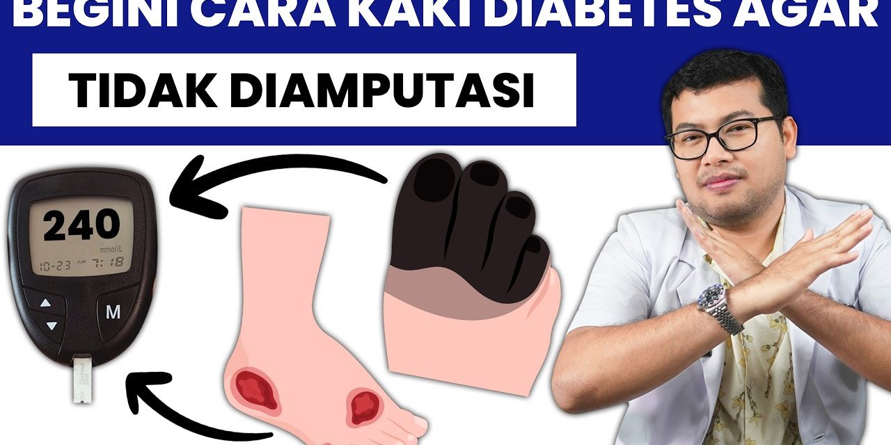 Waspada Kaki Diabetes, 18,6 Juta Orang Terkena Setiap Tahun