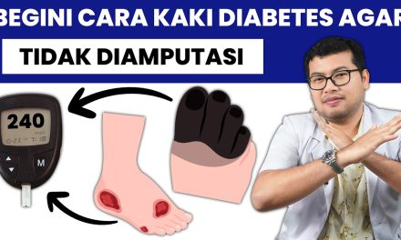 Waspada Kaki Diabetes, 18,6 Juta Orang Terkena Setiap Tahun
