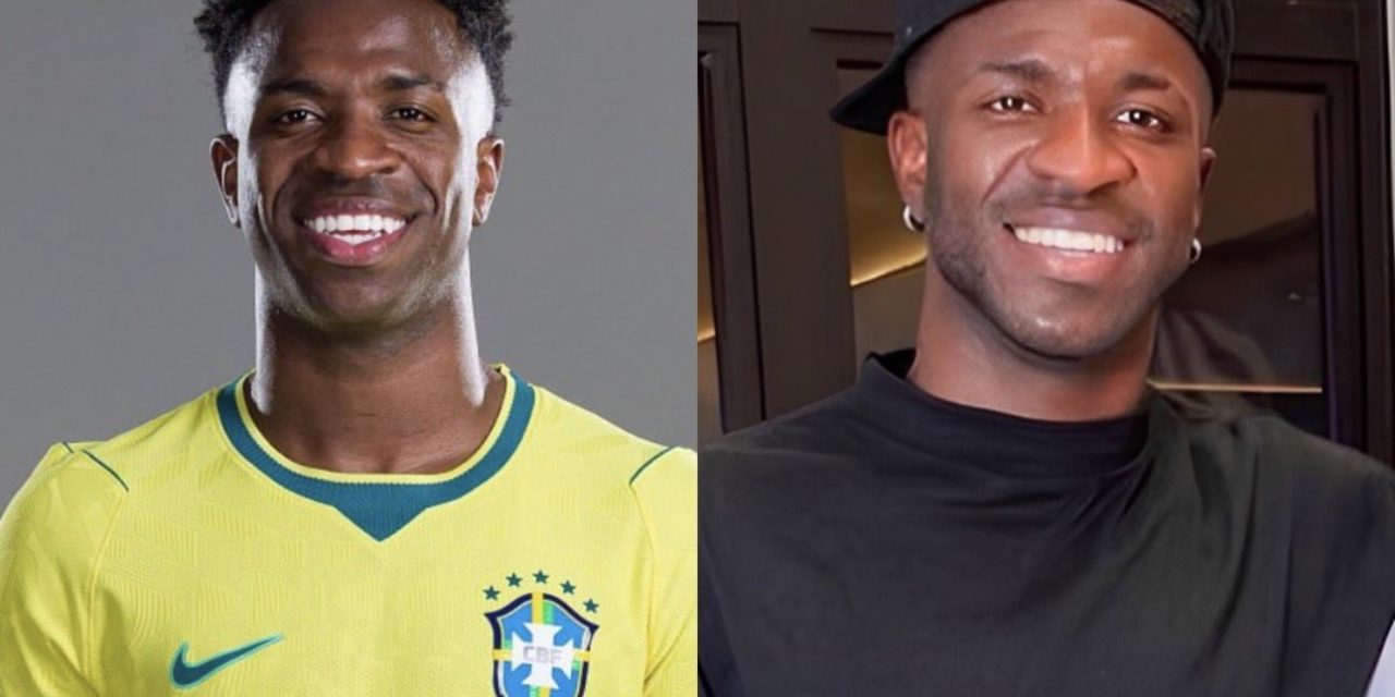 Pangling Banget! Wajah Vinicius Berubah Drastis Usai Operasi